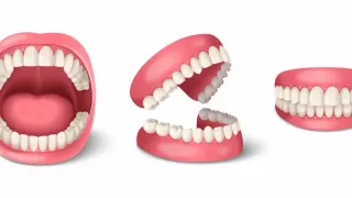 Dentures