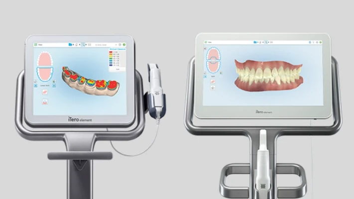 Itero Intraoral Scanner