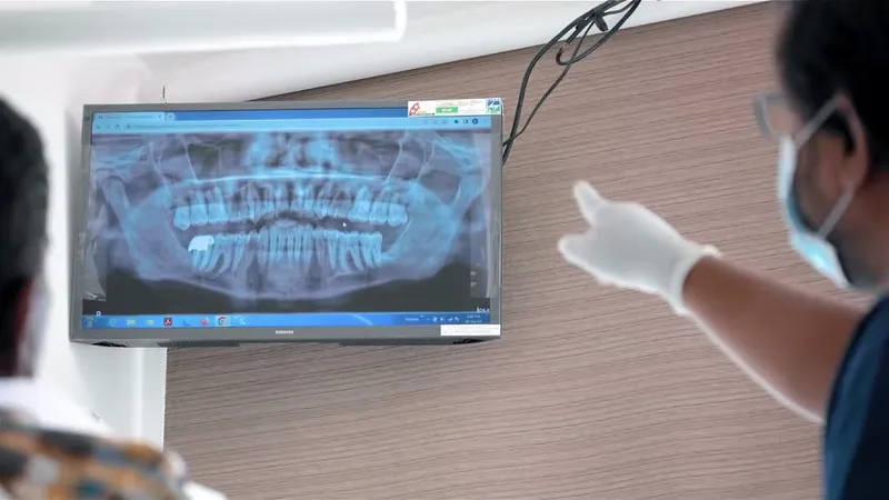 Digital OPG X-Ray Machine in Chennai | Anji Dental care