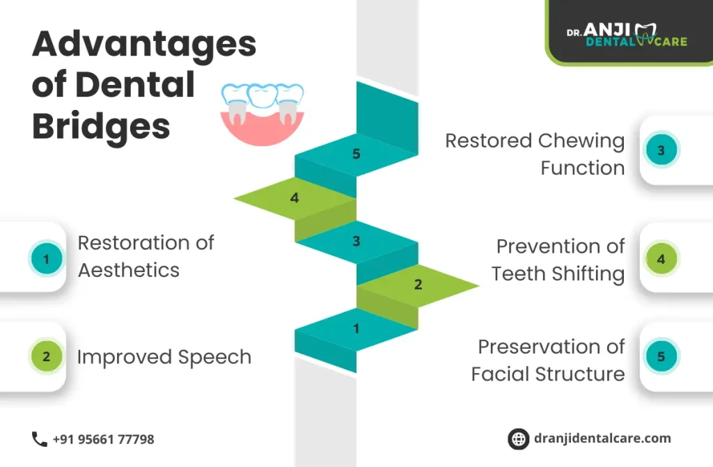 Dental Bridges in Chennai | Anji Dental care