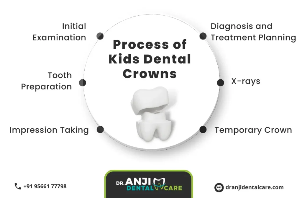 Kids Dental crowns in Chennai