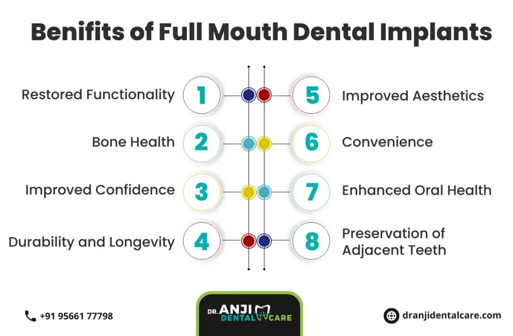 full mouth dental implants in chennai | Anji Dental Care