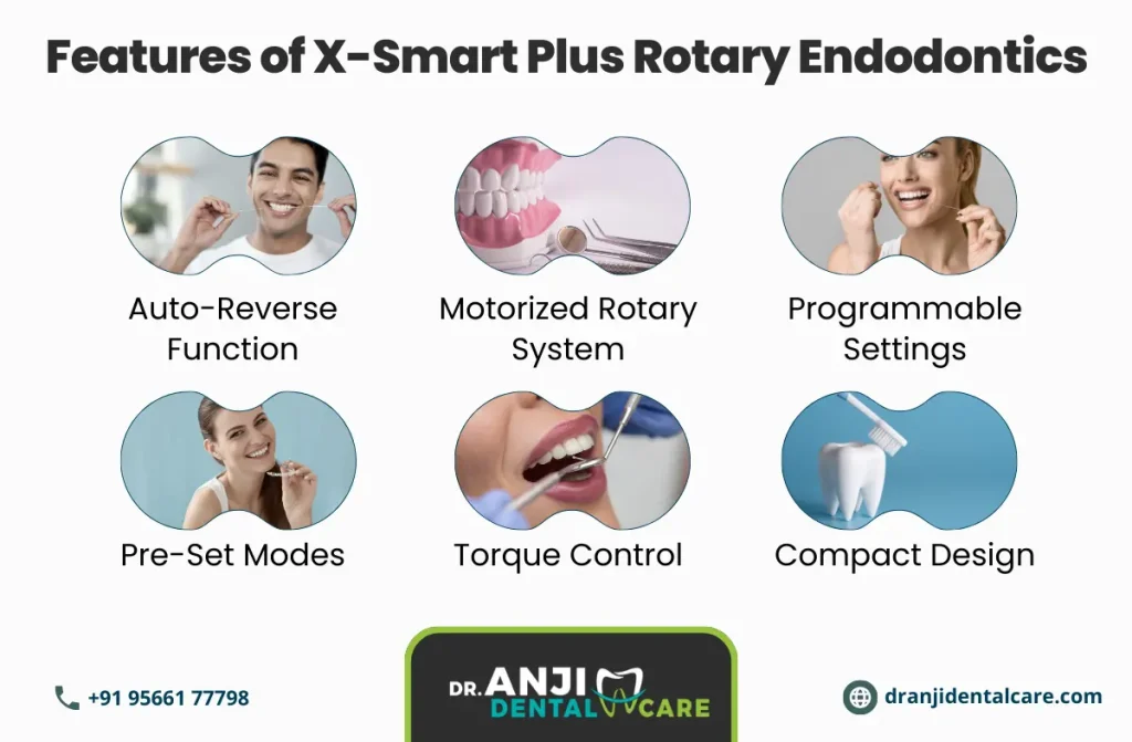 X-Smart Plus Rotary Endodontics in chennai | Anji dental care
