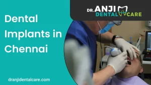 Dental Implants in Chennai | AnjiDental care