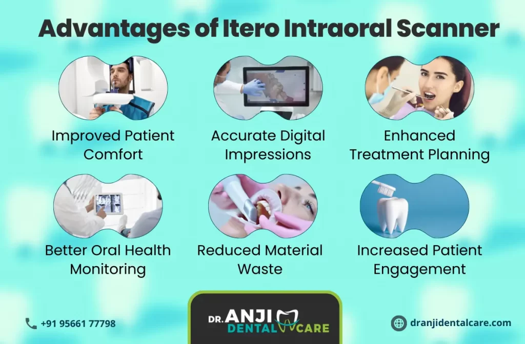 Itero scanner in Chennai | Anji Dental Care