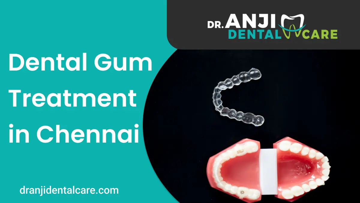dental gum treatment in chennai | AnjiDental care