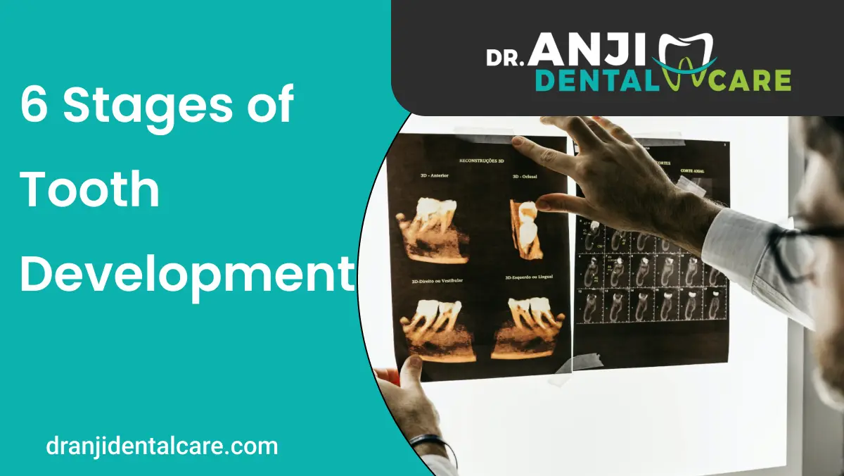 6 stages of tooth development | Anjidental care