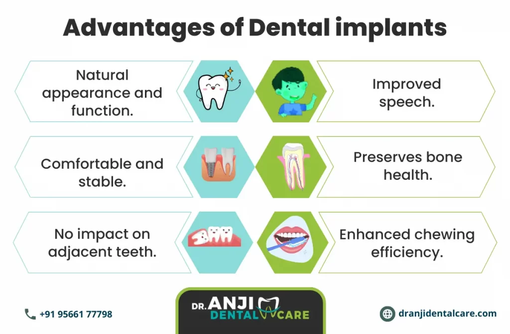 Dental implants in chennai | Dr. Anji Dental Care