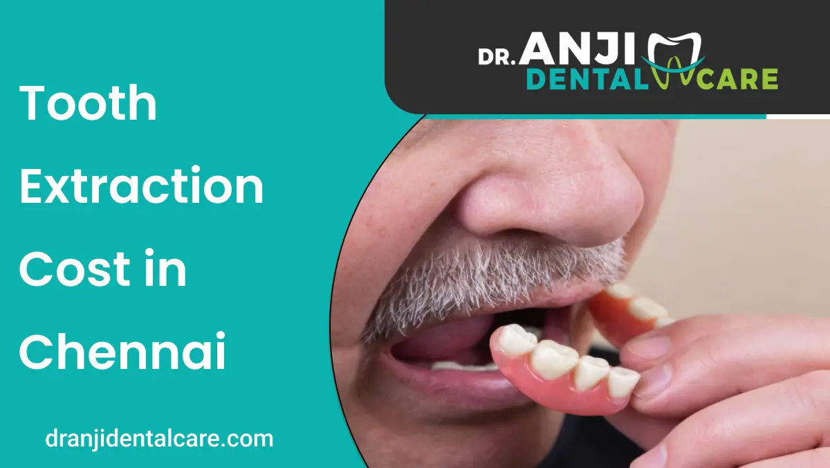 Tooth Extraction Cost in Chennai | Anji Dental Care