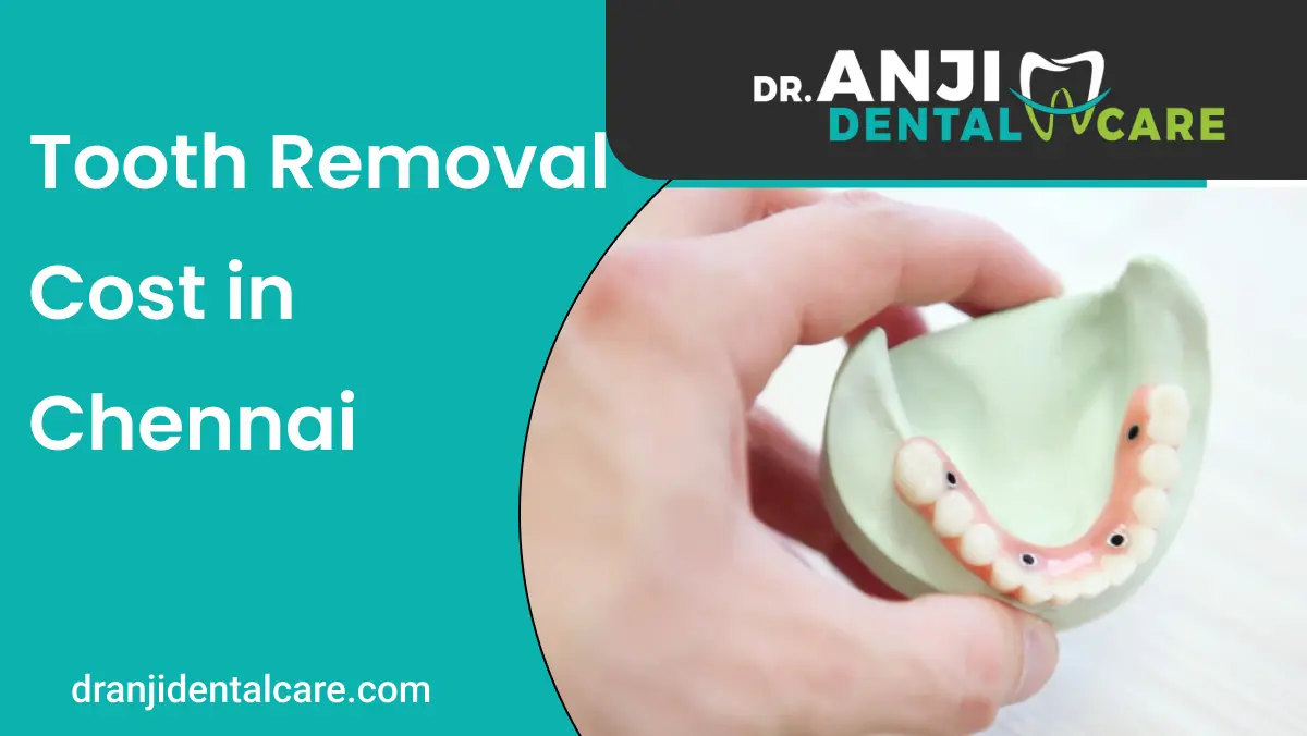Tooth Removal Cost in Chennai | AnjiDental care