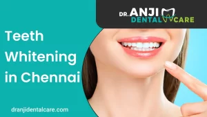 teeth whitening in chennai | Anji Dental Care