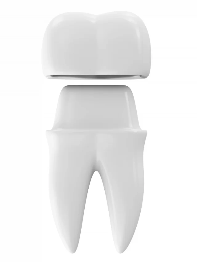 dental-crown-tooth