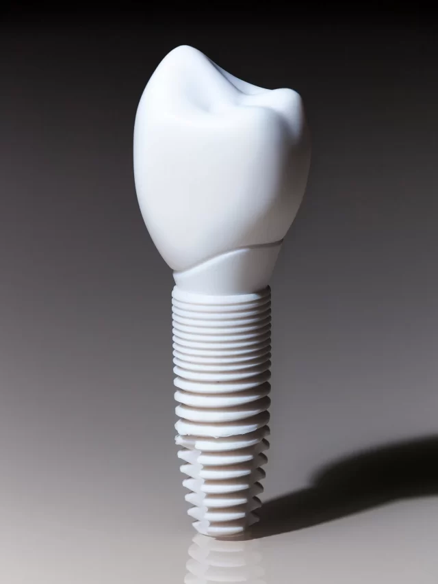 dental-implant-dentist-tooth-medicine-artificial-tooth-tooth-layout-plastics-man-teeth