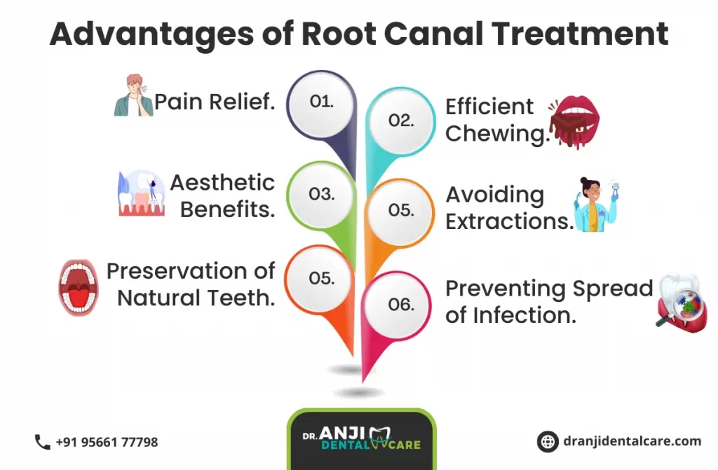 root-canal-treatment-in-Chennai