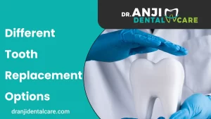 Different Tooth Replacement Options | Anji Dental Care