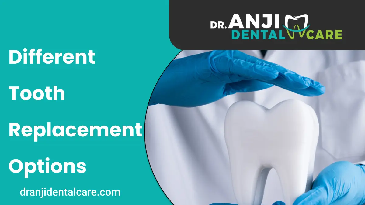 Different Tooth Replacement Options | Anji Dental Care