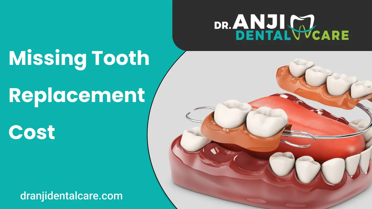 Missing Tooth Replacement Cost | Anji Dental Care