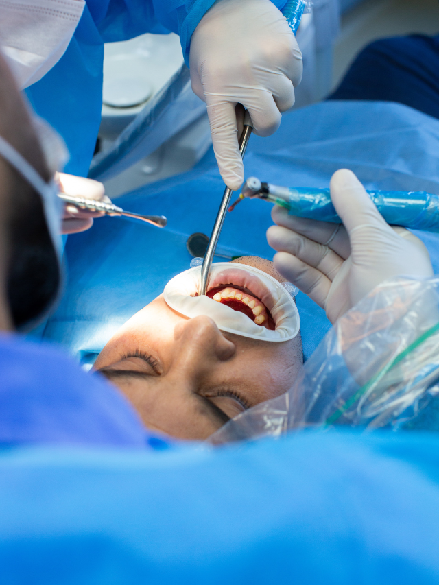  How to choose oral and maxillofacial surgeon in chennai
