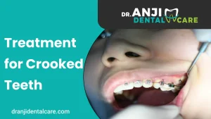 Treatment for Crooked Teeth | Anji Dental Care