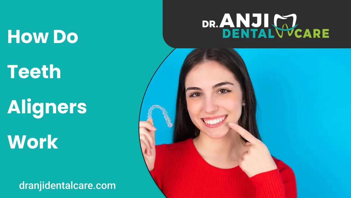 how do teeth aligners work | Anji Dental Cre