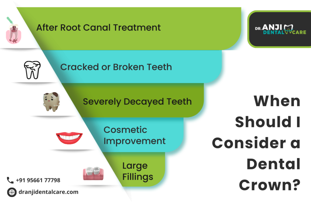 Dental Crowns in Chennai 
