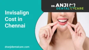 Invisalign Cost in Chennai